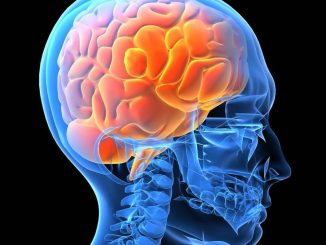 МРТ мозга при эпилепсии